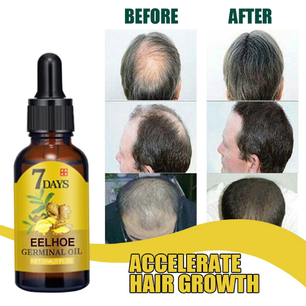 Ginger Hair Care Wonder